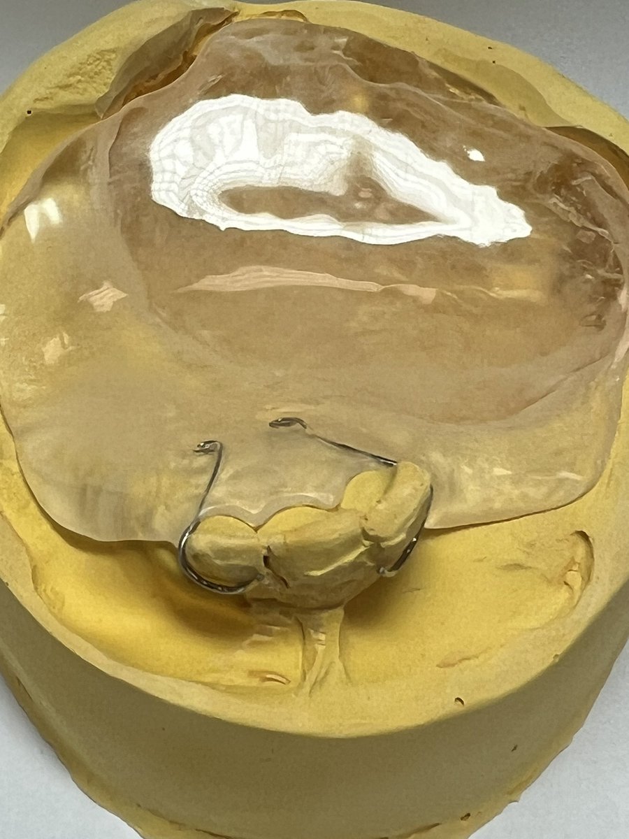 From last week's achievements
The obturator case
Real Cases &amp; Lessons👍🏻