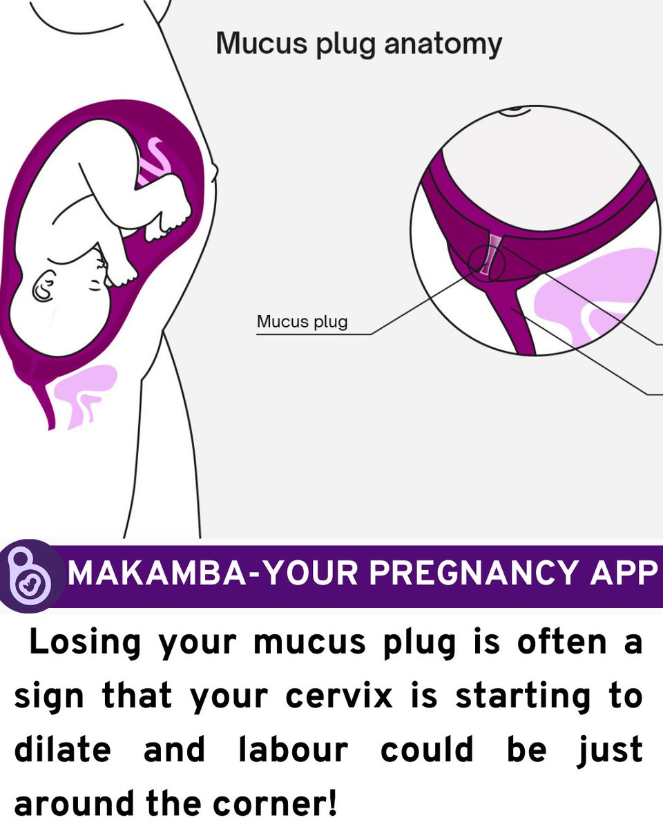 MyMakamba's tweet photo. Mucus and contractions are signs of labor. 

How was your labour experience ? https://t.co/k1X0Jp0w2Y