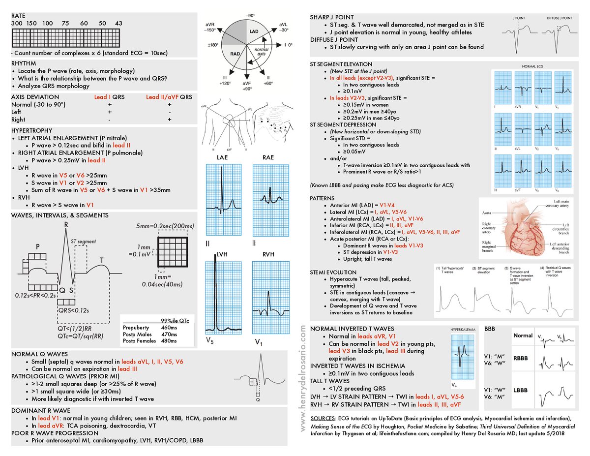 ENARM_intensivo's tweet photo. 💢INTERPRETACIÓN  DEL  ELECTROCARDIOGRAMA

#ENARM_INTENSIVO #ESTUDIA_MEDICINA https://t.co/JDYq7xzt7Q