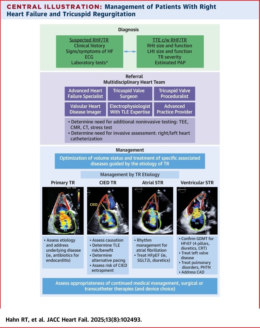 🔴Current Evidence on Tricuspid Regurgitation Interventions in Heart Failure⤵️State-of-the-Art  #2025Review <a href="/JACCJournals/">JACC Journals</a>

🔹jacc.org/doi/10.1016/j.…
 #Cardiology #FOAMed #MedEd #medstudent #paramedic #Cardiology #CardioEd #medtwitter #meded #CardioTwitter #cardiotwiteros  #MedX