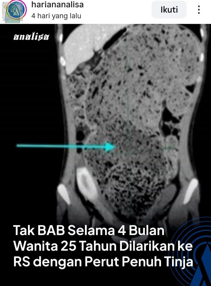 tanyarlfes's tweet image. 💚 syokk banget liatnya... kaya, kok bisa gituloh😭😭

cr di pict