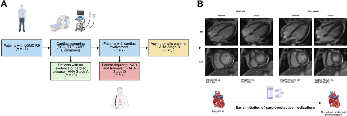 ChanduSadasivan's tweet photo. I am pleased to share our work on Screening for Cardiac Involvement and Early Initiation of Therapies in LGMD R9, just published in #JACCHF @GOuditResearch @JACCJournals 

https://t.co/eKRrCKsu0v https://t.co/BwAGK003gR