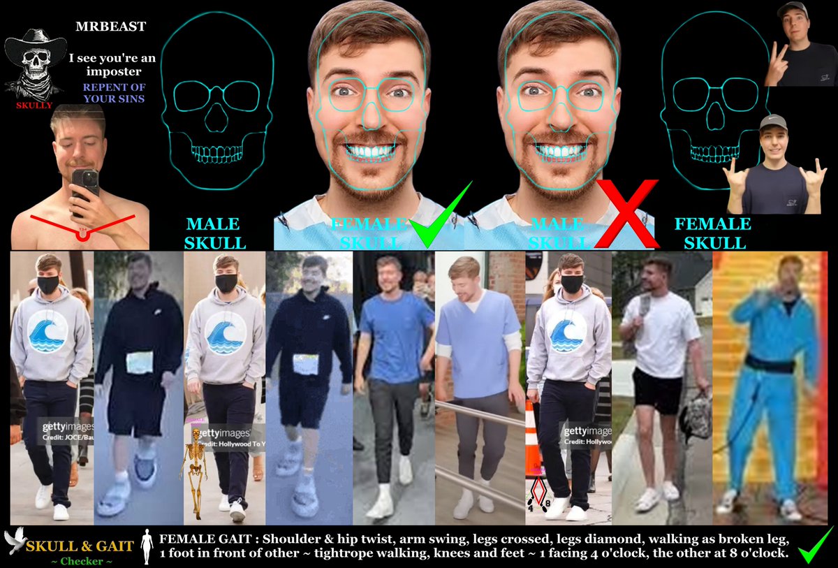 Skull & Gait (@skullandgait) on Twitter photo James Stephen "Jimmy" Donaldson, known as MrBeast,
American YouTuber, media personality, and businessman.
- Bio Female Nordic skull fit and female gaits
#EGI #Forensics James Stephen "Jimmy" Donaldson, known as MrBeast,
American YouTuber, media personality, and businessman.
- Bio Female Nordic skull fit and female gaits
#EGI #Forensics