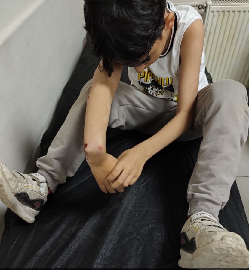 Hakkari'de bir uzman çavuş, eşine "bisikletle çarptığını" iddia ettiği 9 YAŞINDAKİ çocuğu darp ederek kolunu kırdı.

Gözaltına alınan uzman çavuş, serbest bırakıldı.