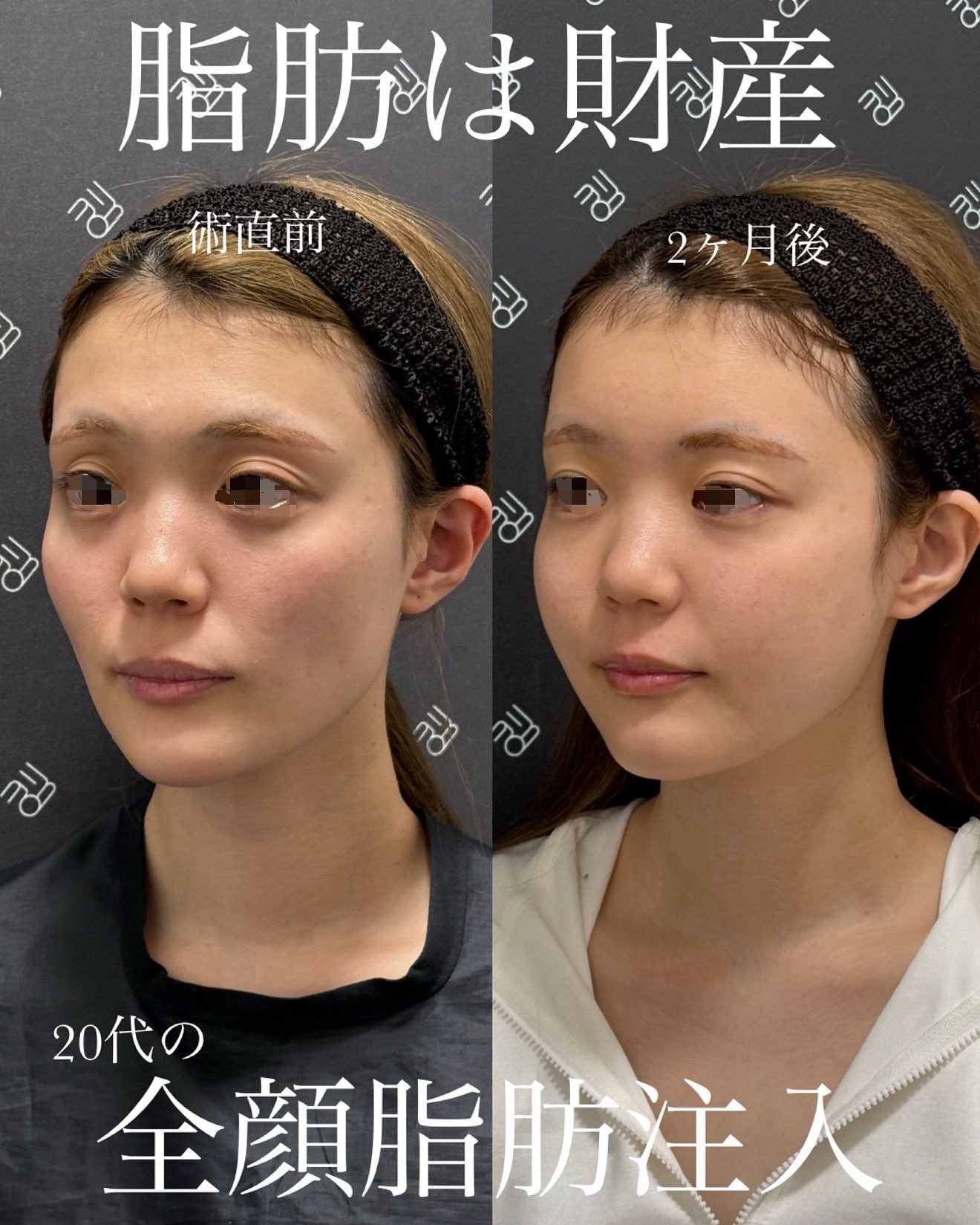 クマさん専用 メガ暖 白くまくん エアコン おもに8畳 日立 2024年モデル XK
