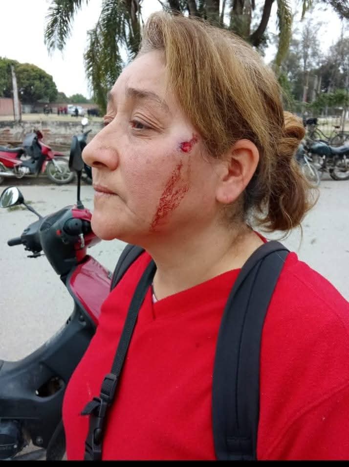 Andre_Villegas1's tweet photo. Repudio total a la represión de lxs trabajadorxs de Hipólito Yrigoyen 😡

La intendente saensista de la ciudad de Hipólito Yrigoyen, Soledad Cabrera, mando a reprimir a los trabajadores municipales, dejando más de 25 heridos y uno con pérdida ocular. 🧵 https://t.co/5vEjtR7EQh