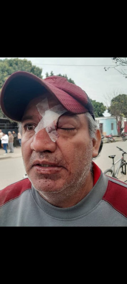 Andre_Villegas1's tweet photo. Repudio total a la represión de lxs trabajadorxs de Hipólito Yrigoyen 😡

La intendente saensista de la ciudad de Hipólito Yrigoyen, Soledad Cabrera, mando a reprimir a los trabajadores municipales, dejando más de 25 heridos y uno con pérdida ocular. 🧵 https://t.co/5vEjtR7EQh