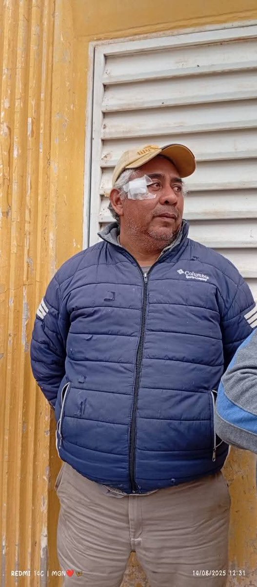 Andre_Villegas1's tweet photo. Repudio total a la represión de lxs trabajadorxs de Hipólito Yrigoyen 😡

La intendente saensista de la ciudad de Hipólito Yrigoyen, Soledad Cabrera, mando a reprimir a los trabajadores municipales, dejando más de 25 heridos y uno con pérdida ocular. 🧵 https://t.co/5vEjtR7EQh