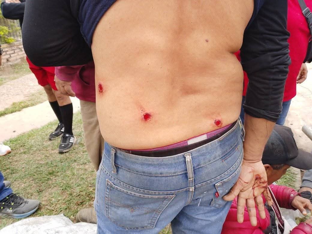 Repudio total a la represión de lxs trabajadorxs de Hipólito Yrigoyen 😡

La intendente saensista de la ciudad de Hipólito Yrigoyen, Soledad Cabrera, mando a reprimir a los trabajadores municipales, dejando más de 25 heridos y uno con pérdida ocular. 🧵