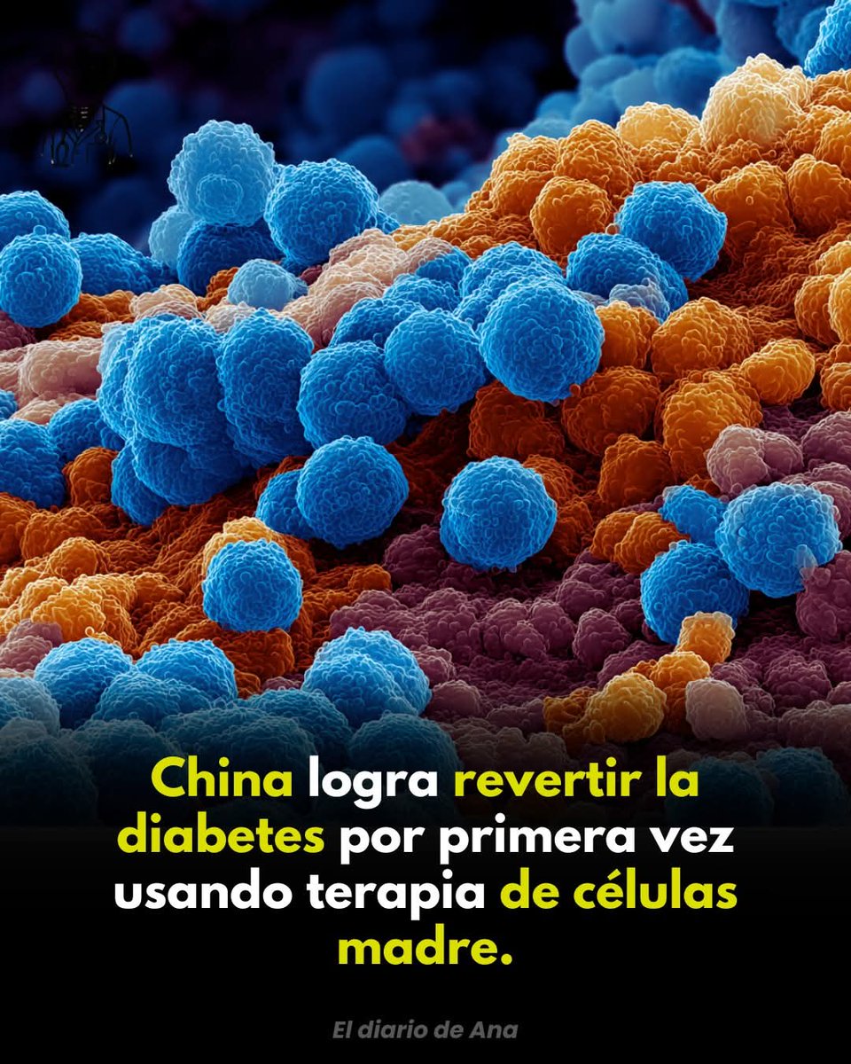 &lt;&lt;🚨| China logra revertir la diabetes con terapia de células madre por primera vez: un avance médico histórico ha permitido que pacientes con diabetes tipo 2 recuperen la producción natural de insulina, eliminando la necesidad de inyecciones diarias. 🩸🧬🇨🇳

El tratamiento
