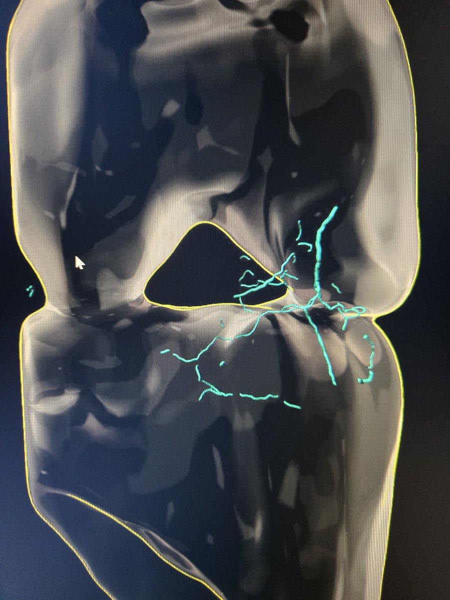 isazeezolakunle's tweet image. Beaut of Science 
#Microscopy #Lightsheet