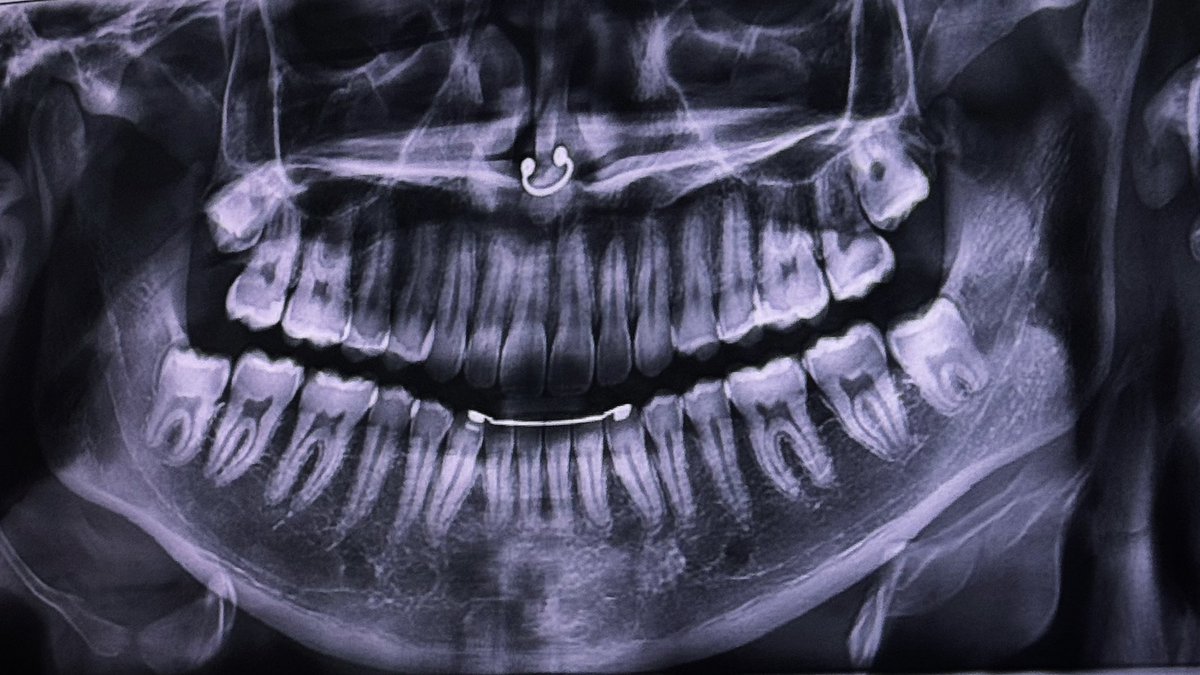 elvisious's tweet image. 👤 @elvisious 
💿 ALIVE [10 SONGS]
🛅 OUT NOW ***
album.link/alive