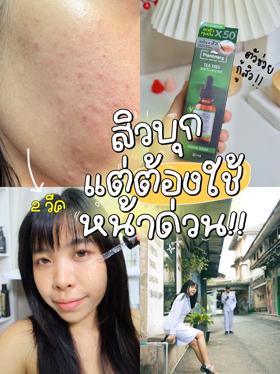 ampmaipim's tweet photo. ทริคเปลี่ยนผิว ฉบับคนรีบใช้หน้า💕

2 Weeks to Glow Up
มีเวลาแค่ 2 อาทิตย์ก่อนวันถ่ายรูป เลยต้องรีบกู้หน้าด่วน 🫣
คือนัดกับแฟนไว้แล้วไงว่าปีนี้อยากไปถ่ายรูปคู่เป็นชุดขาวเก็บไว้ดูเป็นความทรงจำไรงี้✨

แต่มันติดที่ว่าเวลาที่เราต้องใช้ทีไรมันก็จะเป็นอย่างนี้ตลอด https://t.co/CG8O2nCkR3
