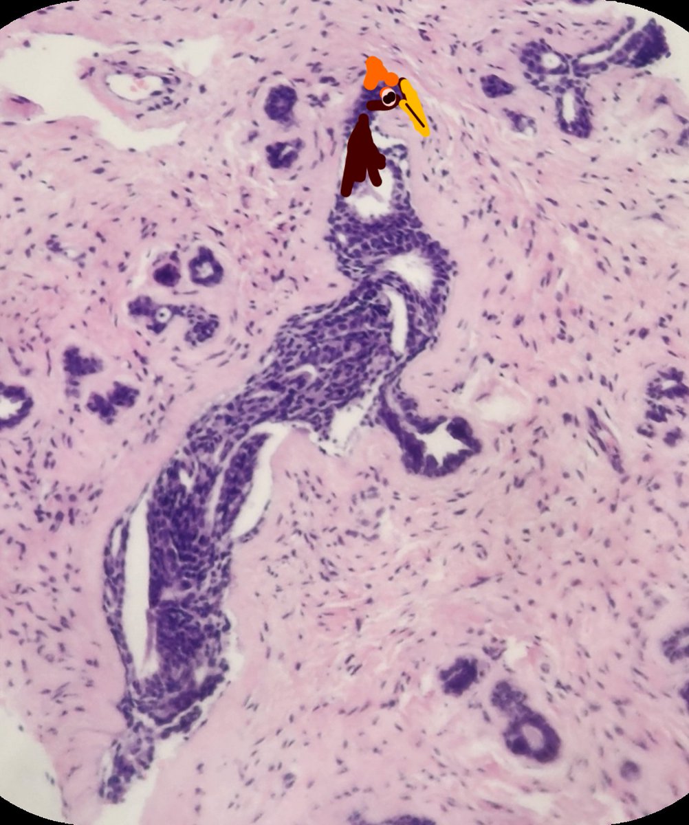 #histopathology 
#pathoart
#pathX
#pathTwitter
Resting peacock !!
Art in Pathology.