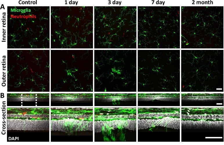 Michael F. Chiang, MD (@neidirector) on Twitter photo New research suggests that a type of cloaking occurs during retinal injury to protect the retina from a rush of immune cells that could do more harm than good.
<a href="/FlaumEye/">Flaum Eye Institute</a> <a href="/CvsUor/">CVSUoR</a> <a href="/URNeuroscience/">Del Monte Institute for Neuroscience</a> <a href="/schalleklab/">SchallekLab</a> #NIHfunded
<a href="/eLife/">eLife - the journal</a> paper: brnw.ch/21wUWmN New research suggests that a type of cloaking occurs during retinal injury to protect the retina from a rush of immune cells that could do more harm than good.
<a href="/FlaumEye/">Flaum Eye Institute</a> <a href="/CvsUor/">CVSUoR</a> <a href="/URNeuroscience/">Del Monte Institute for Neuroscience</a> <a href="/schalleklab/">SchallekLab</a> #NIHfunded
<a href="/eLife/">eLife - the journal</a> paper: brnw.ch/21wUWmN