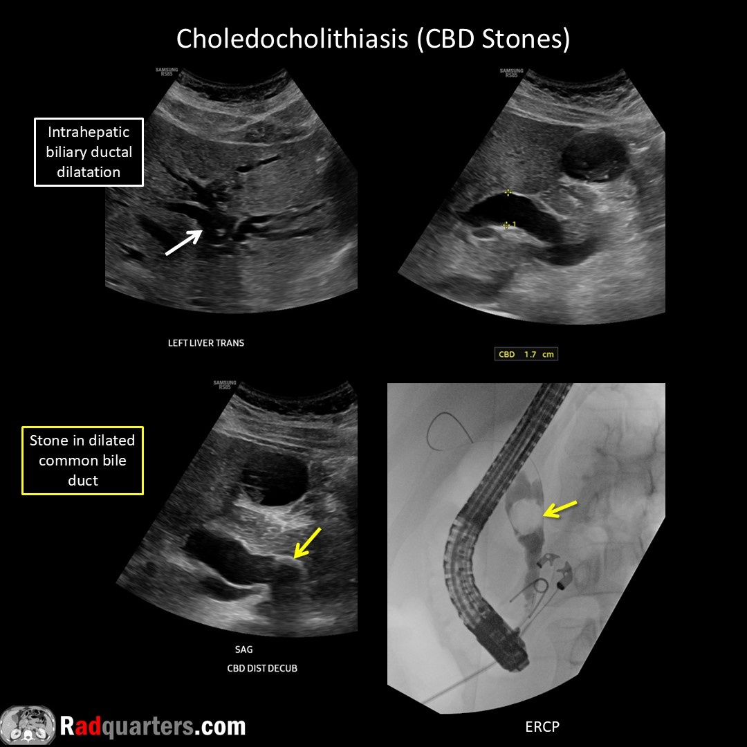 Daniel Kowal, MD, RMSK | Radquarters (@radquarters) on Twitter photo 📽️ Watch video to learn more: youtu.be/L6Klbaxp_eE
#FOAMrad #FOAMed #usrad #radres #radtech #medstudent #radquarters <a href="/BostonImaging/">Boston Imaging</a> <a href="/SamsungHealth/">Samsung Healthcare</a> 📽️ Watch video to learn more: youtu.be/L6Klbaxp_eE
#FOAMrad #FOAMed #usrad #radres #radtech #medstudent #radquarters <a href="/BostonImaging/">Boston Imaging</a> <a href="/SamsungHealth/">Samsung Healthcare</a>