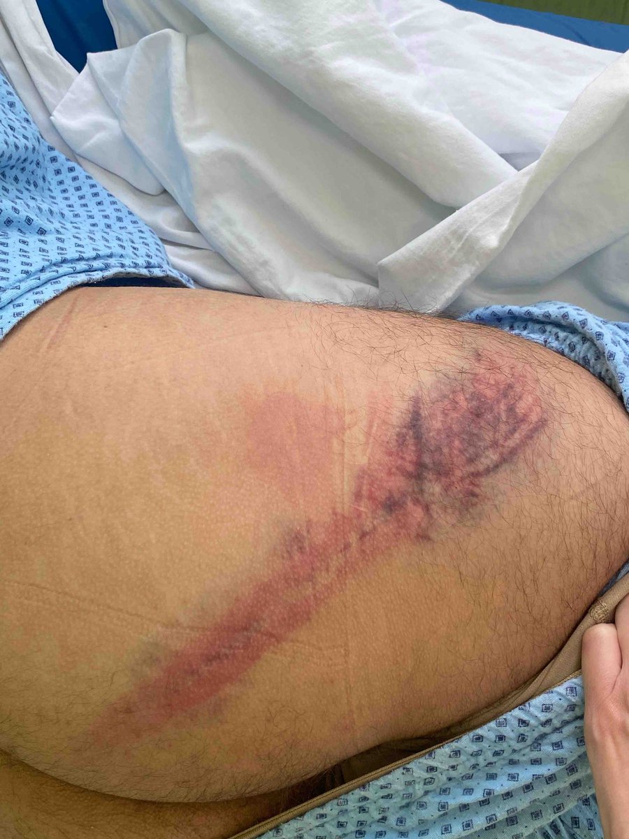 Aleksandra Zarića bivšeg pripadnika Žandarmerije sinoć su u Valjevu krvnički pretukli pripadnici Žandarmerije

Nalazi se na odeljenju kardiologije Valjevske bolnice sa ozbiljnim zdravstvenim problemima

Svi oni koji su učestvovali u mučenju građana moraće po zakonu da odgovaraju!