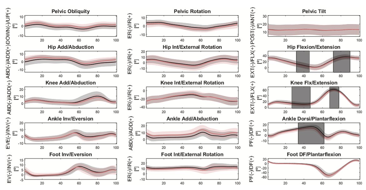 New paper in collaboration with Prof. Daniel Boari!!

Inter-limb #gait #Asymmetry  in people with #Parkinsons disease 

"People with PD showed angular asymmetries in the hip, knee, and ankle in ON and OFF states"

sciencedirect.com/science/articl…

<a href="/AgencyFAPESP/">Agência FAPESP</a> <a href="/Unesp_Oficial/">UNESP</a> <a href="/ufabc/">UFABC</a>