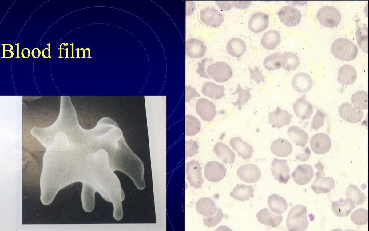 Bread & Butter Haematology tweet media