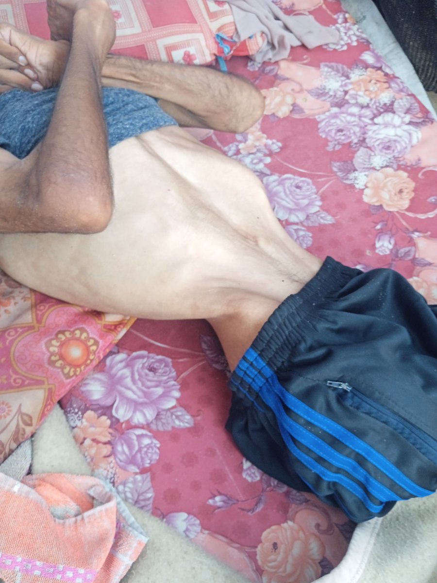 suleiman40 (@slymntbash) on Twitter photo 📢 Dear friends, my uncle’s body is very weak and he urgently needs nutritious food to regain his strength. Even though prices here are somewhat cheaper, we still can’t afford it. I only need $300 to buy food for my uncle. 🙏🍞 #Donate #Help
chuffed.org/project/140170…
<a href="/MothTongue_/">𓂆🔻لسان العثة @gazafunds.com</a> 📢 Dear friends, my uncle’s body is very weak and he urgently needs nutritious food to regain his strength. Even though prices here are somewhat cheaper, we still can’t afford it. I only need $300 to buy food for my uncle. 🙏🍞 #Donate #Help
chuffed.org/project/140170…
<a href="/MothTongue_/">𓂆🔻لسان العثة @gazafunds.com</a>