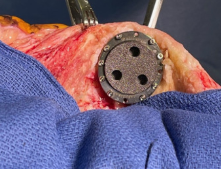 The Journal of Arthroplasty tweet media