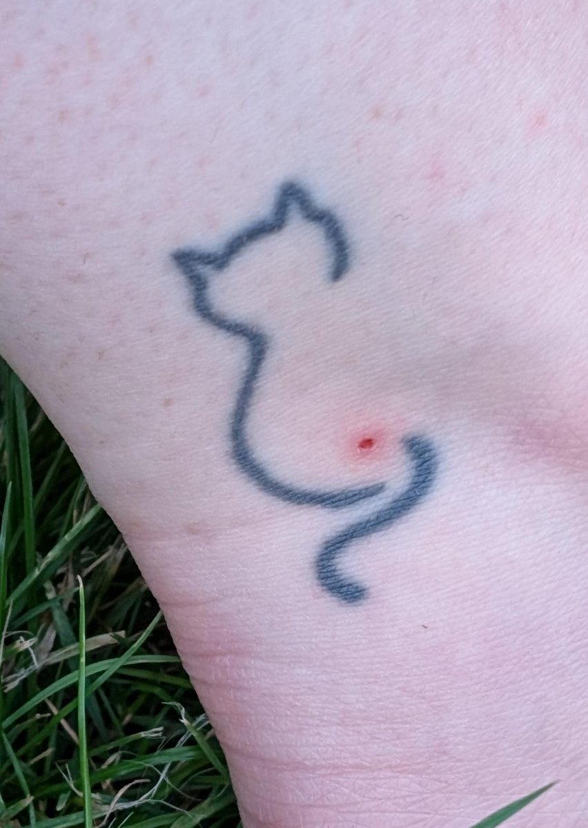 My sister-in-law got a bite on her ankle in a rather unfortunate/hilarious place.