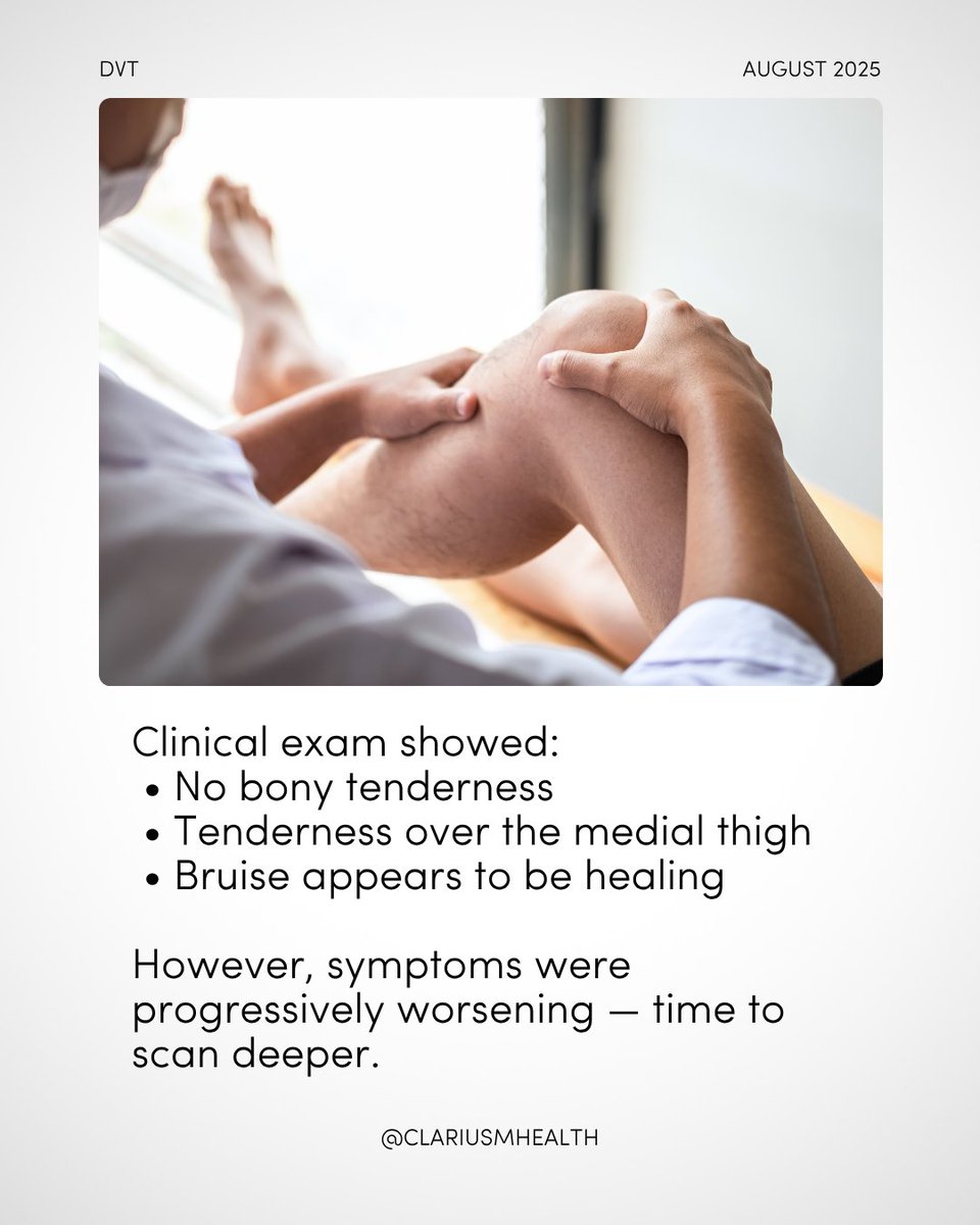 clariusmhealth tweet picture