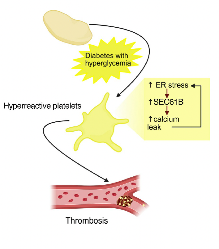 Eric Topol (@erictopol) on Twitter photo Discovery of a mechanism for the increased risk of arterial blood clots in people with diabetes: platelet hyperactivity mediated by SEC61B, calcium balance inside these cells
<a href="/jclinicalinvest/">Journal of Clinical Investigation</a>
jci.org/articles/view/… Discovery of a mechanism for the increased risk of arterial blood clots in people with diabetes: platelet hyperactivity mediated by SEC61B, calcium balance inside these cells
<a href="/jclinicalinvest/">Journal of Clinical Investigation</a>
jci.org/articles/view/…