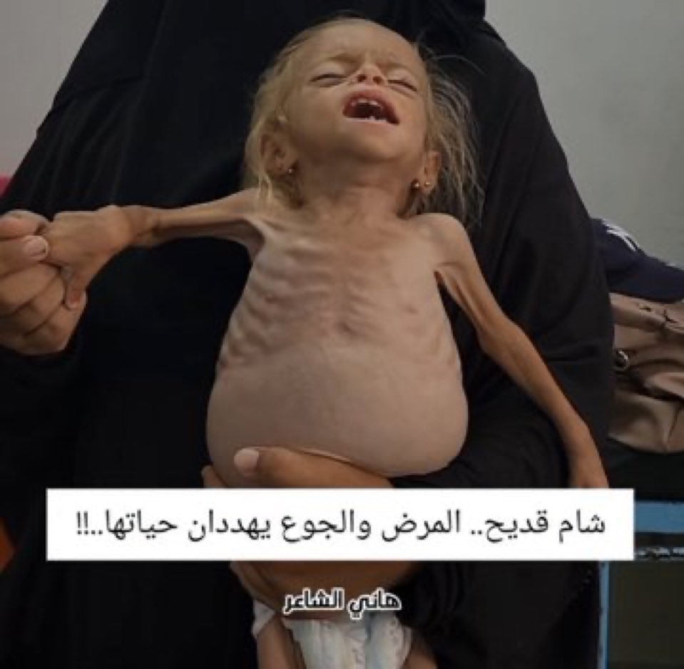 جثث مشروع  اسرائيل الكبري يا عرب 2025