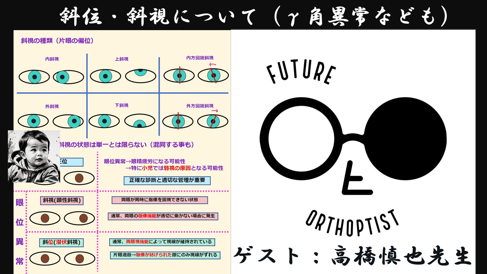視能矯正学  視能訓練士 Amazon.co.jp: 視能訓練学 (視能学エキスパート) : 公益社団法人