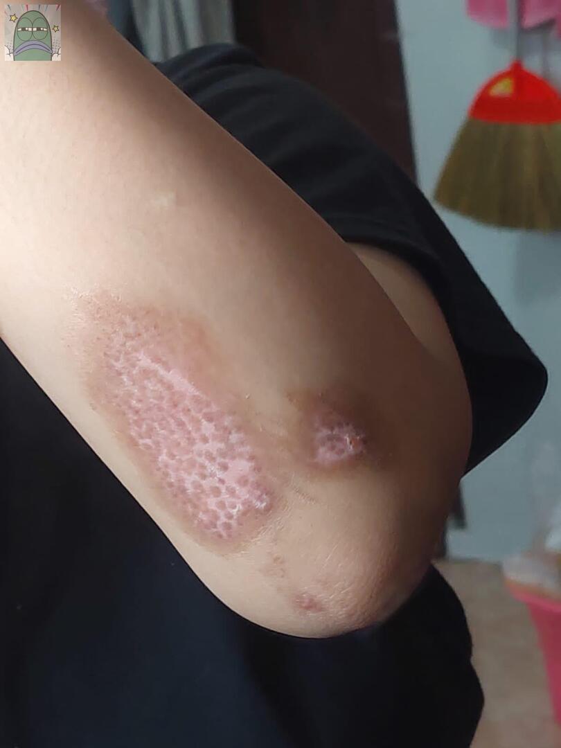 Tanyarlfes tweet media