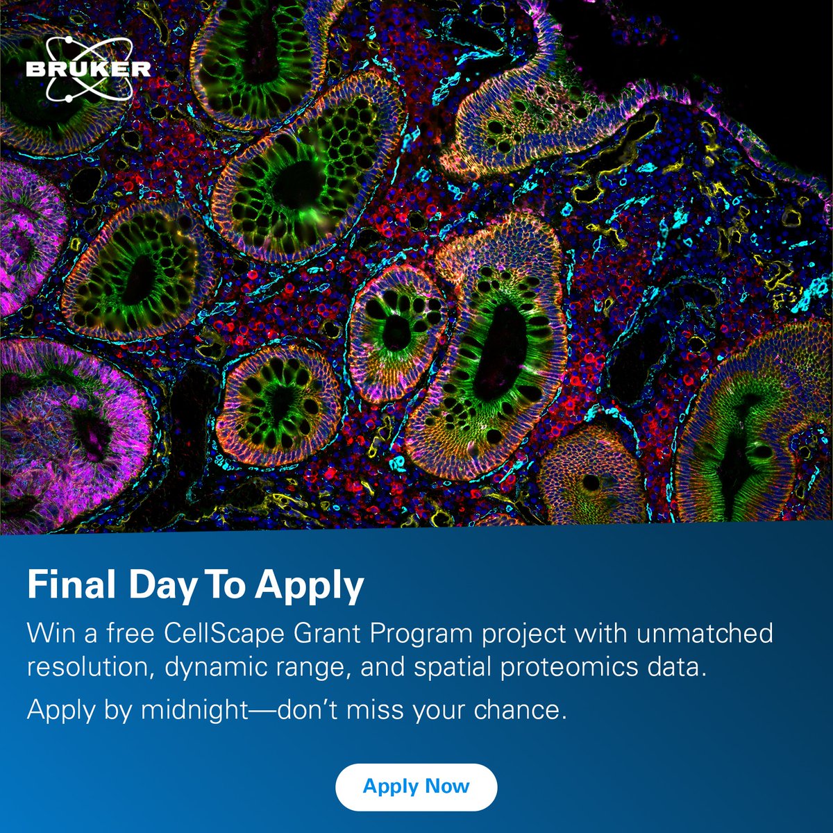 brukerspatial's tweet image. Today, Aug. 15th, is the final day to apply for our CellScape Precise #SpatialProteomics Grant Program! Submit your 250‑word abstract by midnight (PT) for a chance to win up to three human FFPE sections run on the #CellScape platform.
Apply now! go.brukerspatialbiology.com/CellScape-Prec…