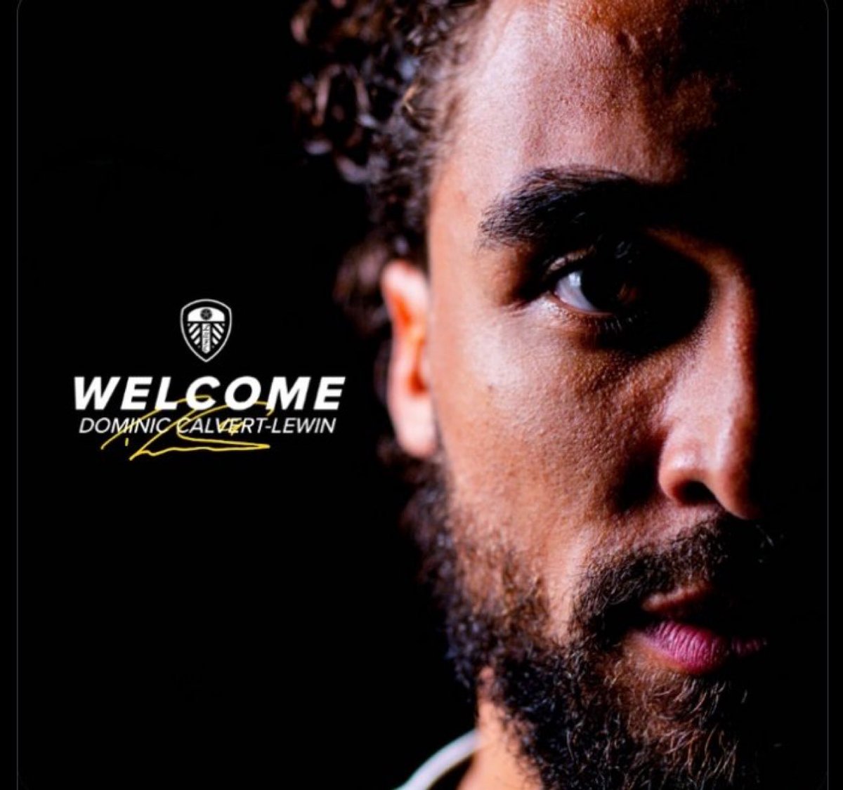 🚨🚨🚨🚨 عاجل — رسمياً 🚨🚨🚨🚨

دومينيك كالفرت لوين لاعباً لنادي ليدز يونايتد 

🟡🔵🟡🔵🟡🔵🟡🔵🟡🔵🟡🔵🟡🔵
✅✅✅✅✅✅✅✅✅✅✅✅✅✅