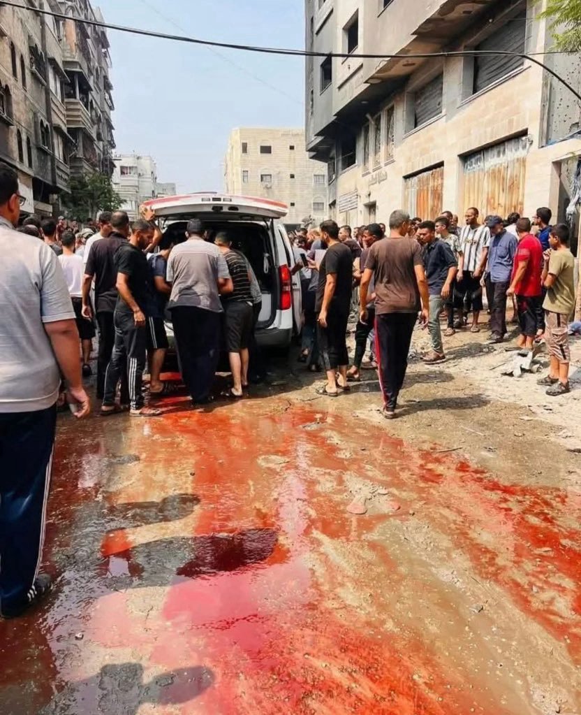 Daha önce  emsali hiç görülmemiş  vahşet  ve zulmü, her geçen gün  arttıran terörist israil'e karşı müdahalede  bulunmak, her  insanın boynunun borcudur.
Allah'ın lâneti ve gazabı terörist israil ve dostlarının üzerine olsun. 
#GazaIsStarving 
#GazaGenocide‌ 
<a href="/UN/">United Nations</a>
<a href="/OIC_OCI/">OIC</a>