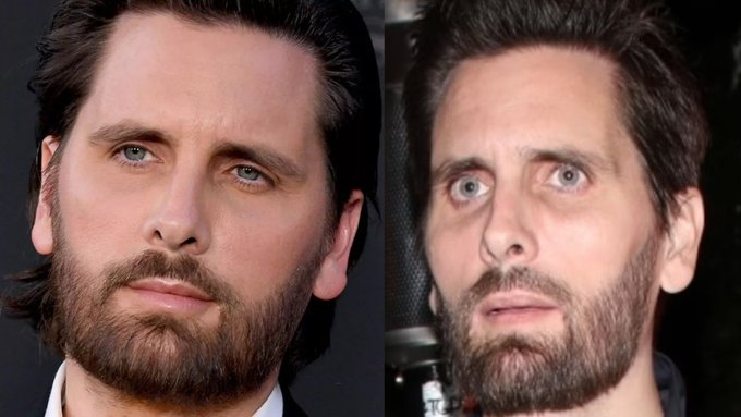 Ozempic.

La última estafa de las grandes farmacéuticas...

Estos son los horrores de Ozempic que te ocultaron (y qué hacer en su lugar):

1. C4ncer de tiroides