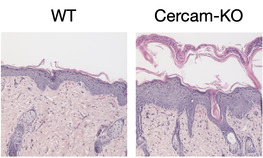 qsonehara's tweet photo. As in-vivo validation, Cercam-knockout in a psoriasis mouse model showed aggravated dermatitis with elevated T-cell retention in the subepidermis. (4/5) https://t.co/06udo4YlUT