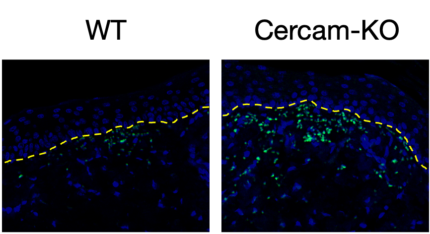 qsonehara's tweet photo. As in-vivo validation, Cercam-knockout in a psoriasis mouse model showed aggravated dermatitis with elevated T-cell retention in the subepidermis. (4/5) https://t.co/06udo4YlUT