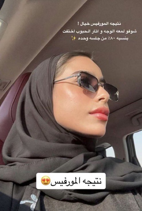 ترو tweet media