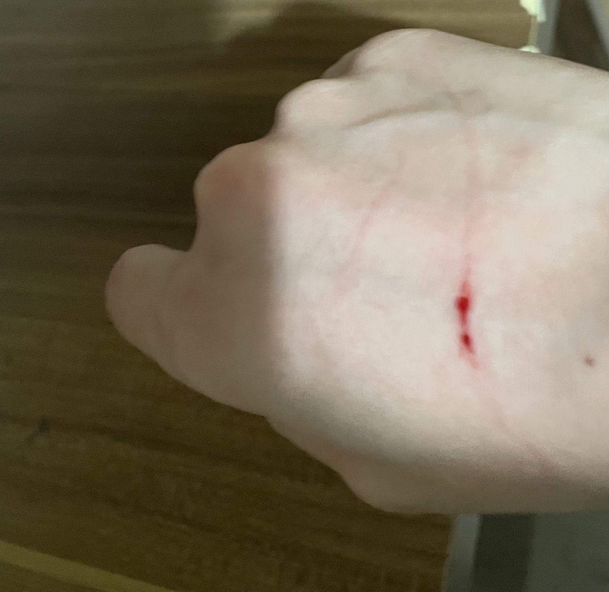 Sokakta karnını doyurduğum kedim ve yaptıkları 🥺