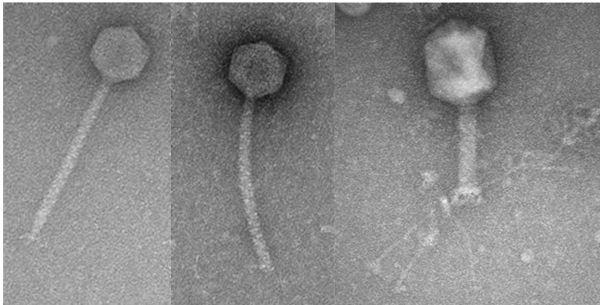 ISVM (@virusofmicrobes) on Twitter photo 🦠Phage Feature of the Week 
 AC03, AT01 & Equilibrator – Acinetobacter baumannii phages revealing how viruses adapt to bacterial defenses.
🔬 TEM:
• Siphoviridae (long tails)
• Myoviridae (contractile tails)
📸 Thanks to Prof. Robert Edwards (Flinders Univ.)
#Bacteriophages 🦠Phage Feature of the Week 
 AC03, AT01 & Equilibrator – Acinetobacter baumannii phages revealing how viruses adapt to bacterial defenses.
🔬 TEM:
• Siphoviridae (long tails)
• Myoviridae (contractile tails)
📸 Thanks to Prof. Robert Edwards (Flinders Univ.)
#Bacteriophages