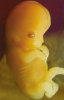 nafoscamzu's tweet photo. Fundraise for injury stalled so I give random facts😅This me at age embryo
-I have same forehead
-Feet looks like man
-Hair fake
-Nails fake
-I fake
Funny part? I lie and the simps give money so I live best life. I go bar party every night. Get anything I want!
Please donate🙏 https://t.co/WSnUf6rmnN