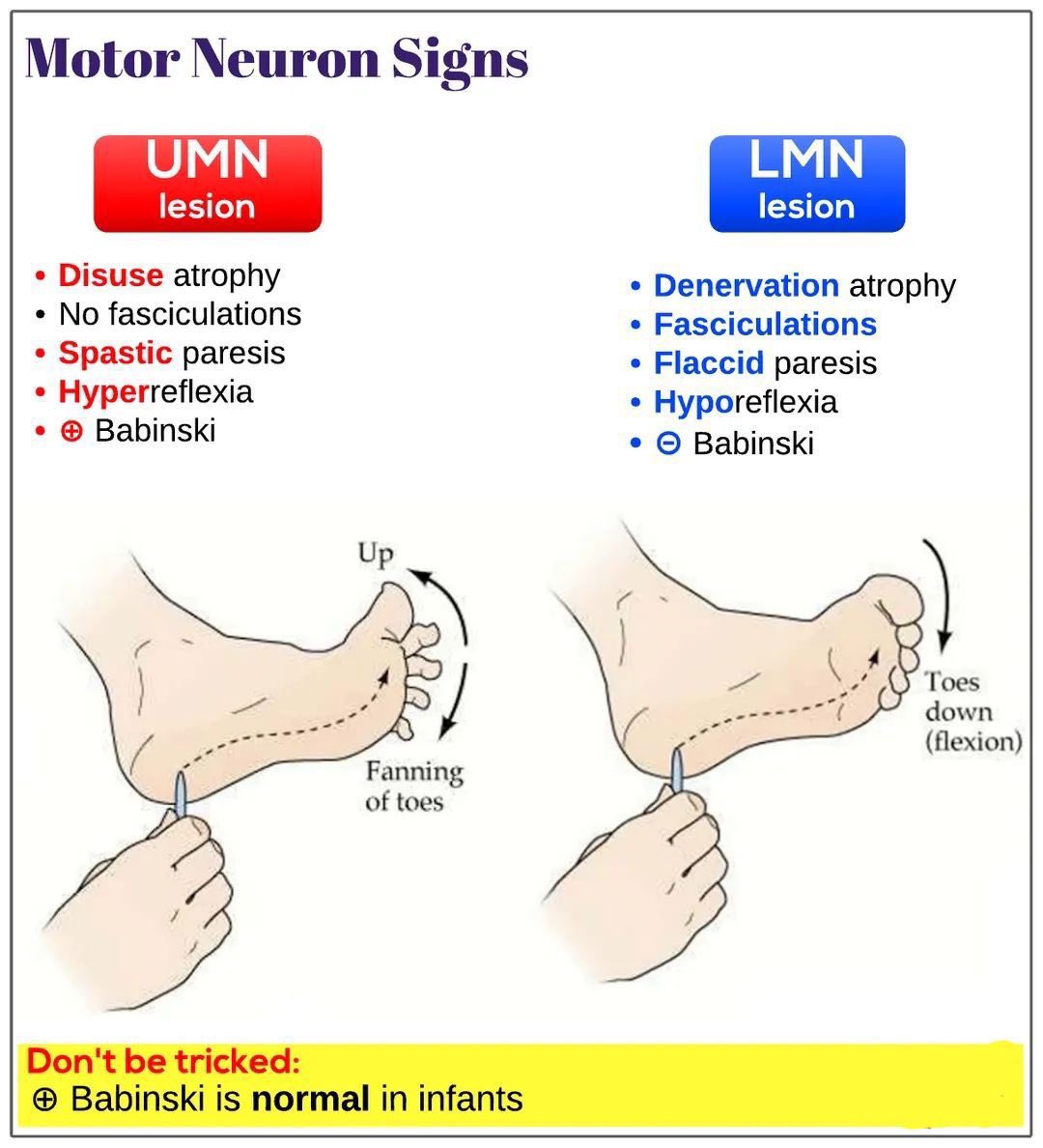 physio_clinics's tweet photo. 👨🏻‍⚕️ Motor Neuron Signs👌👇

🔴 Upper Motor Neuron Lesion (UMN)
🔵 Lower Motor Neuron Lesion (LMN) https://t.co/XSAIXbwyTw