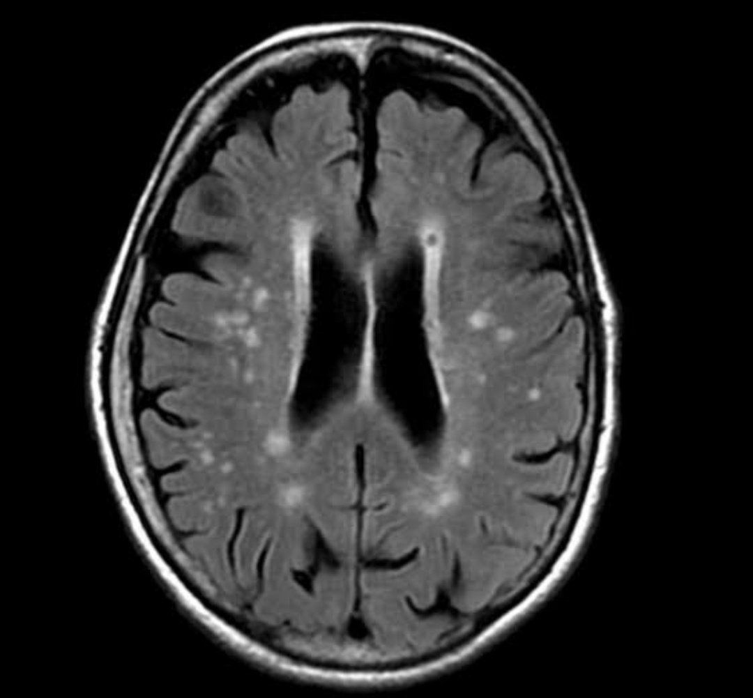 Neuromed tweet media