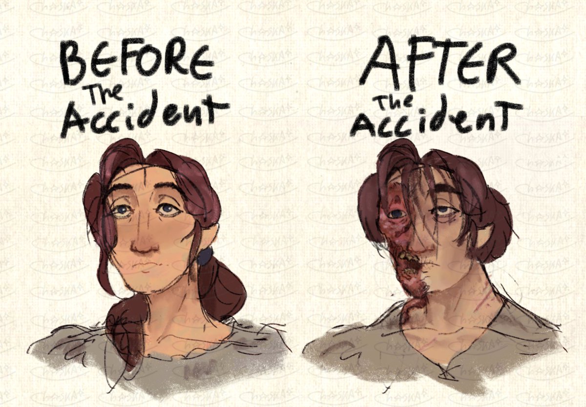 It is a miracle Zurda survived the accident and managed to live a considerable amount of time after it
#art
#overseasstory