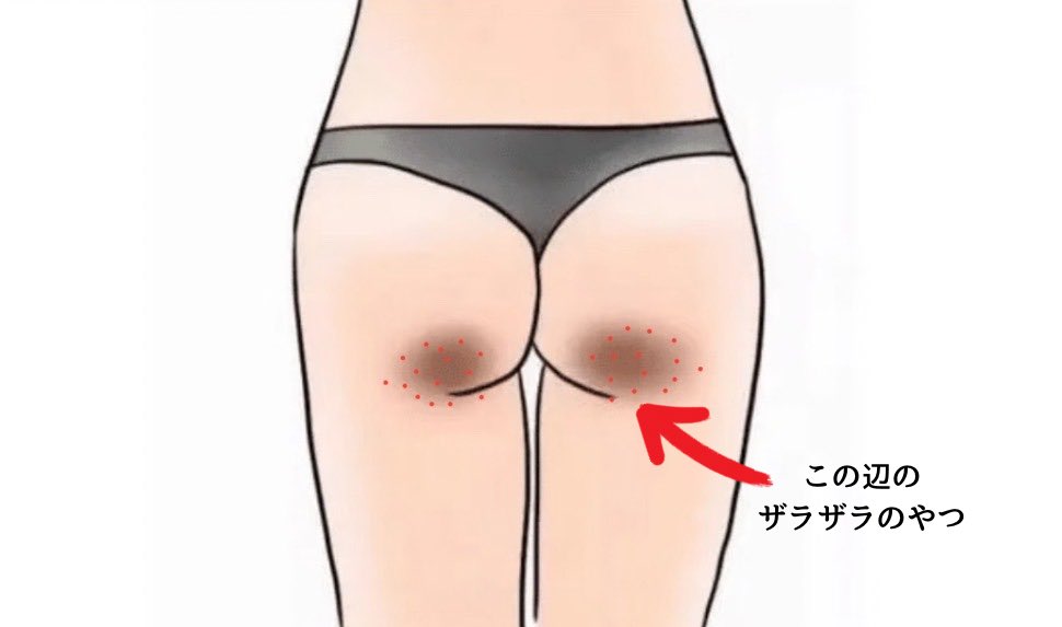 sua_lilb33's tweet photo. ﾎﾝﾄ申し上げにくい話、お尻の付け根？のざらつきが酷くて…色んなケアしてきたけど、このルーティンに変えてザラつきが知らぬ間に居なくなってた😭昨日気づいたけどこれに変えてから。 https://t.co/YFbEMk0dro