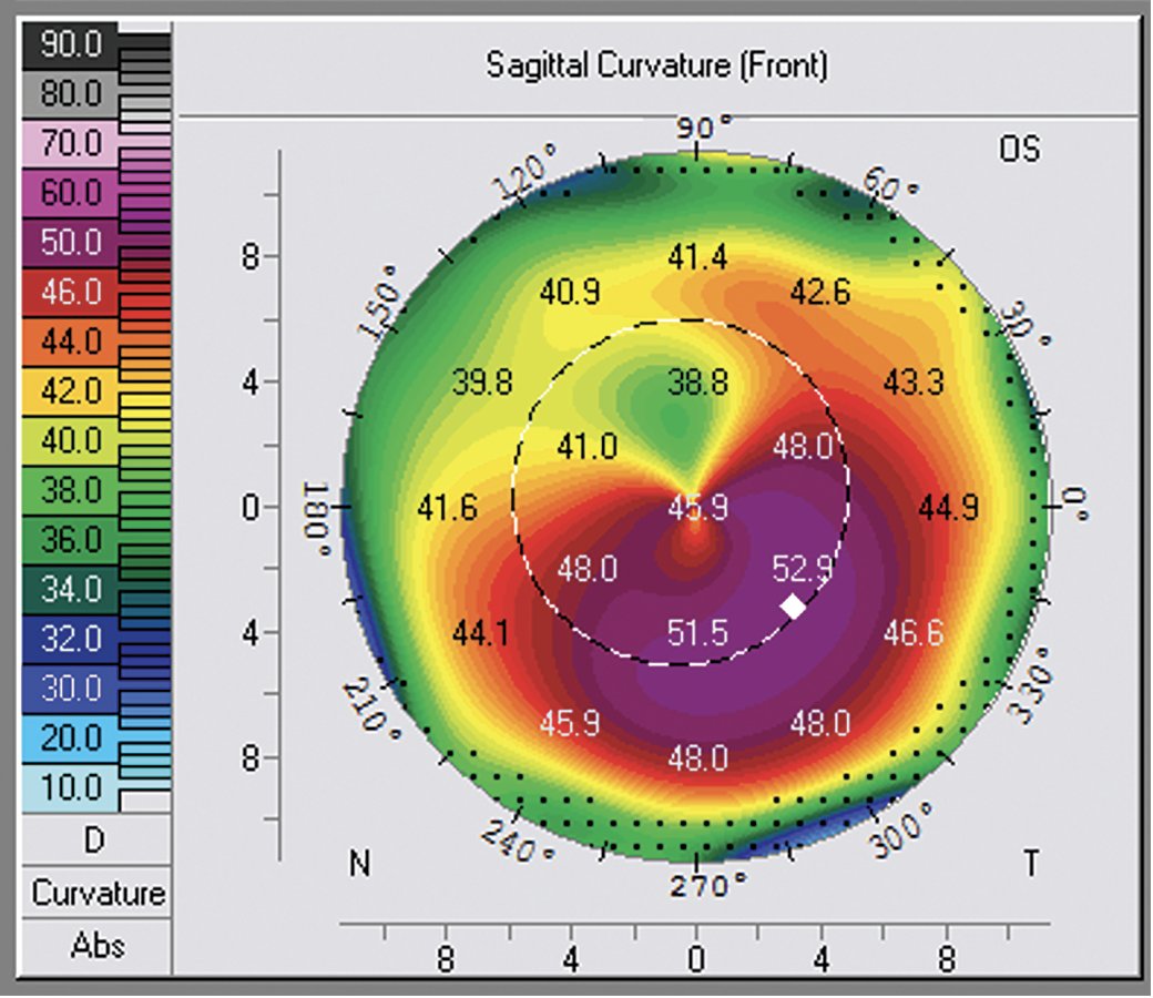 Review of Ophthalmology tweet media