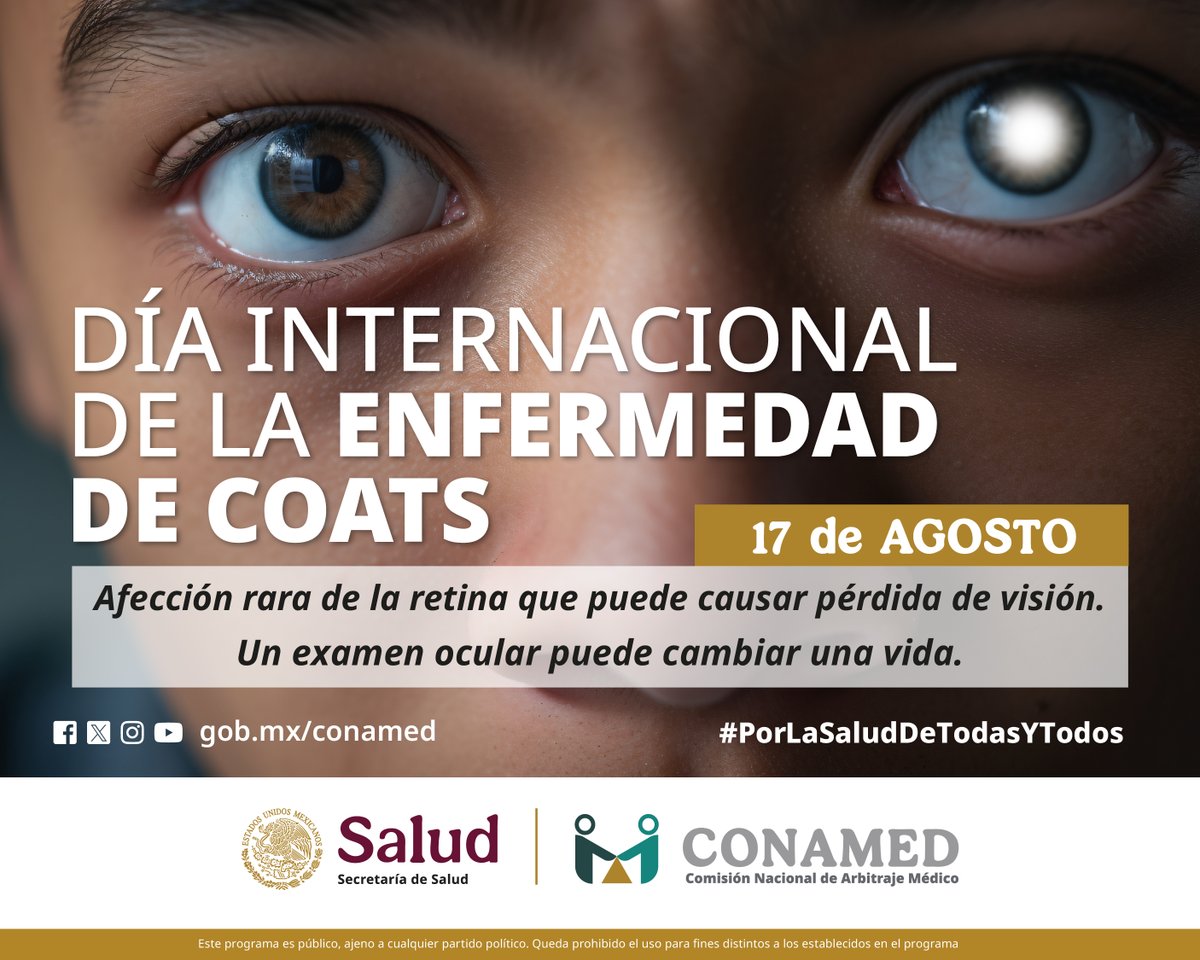 17 de agosto | Día Internacional de la Enfermedad de Coats 👁️
#Efemérides #EnfermedadDeCoats