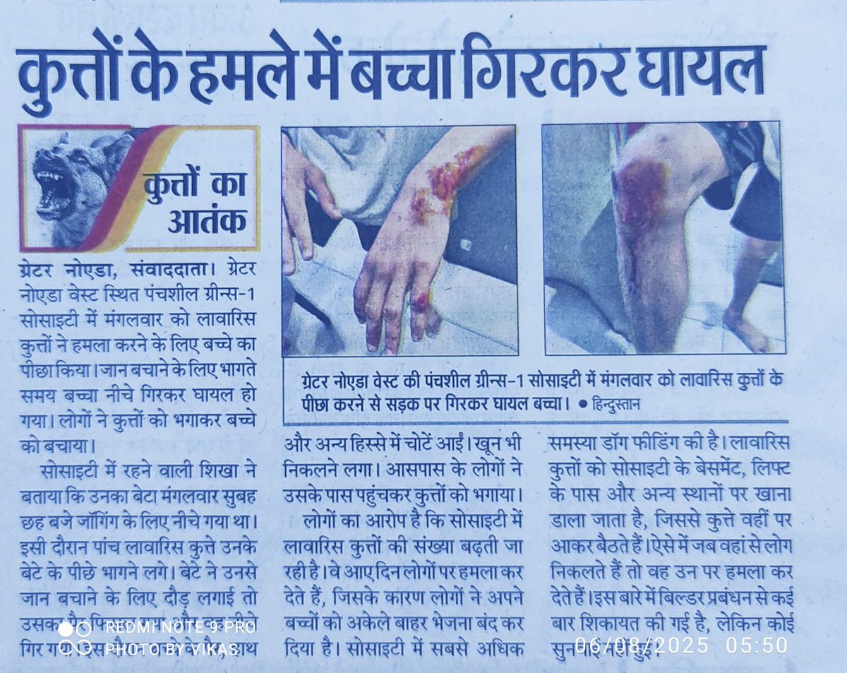 कुत्ते प्रेमीयों ...जरा इधर भी नजर डालो...