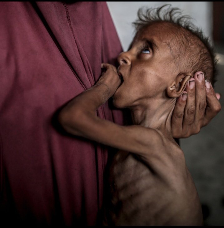 ALAMINH09762172's tweet photo. "The Gaza strip is facing a man made devastating famine." https://t.co/rVoGNNd4ST