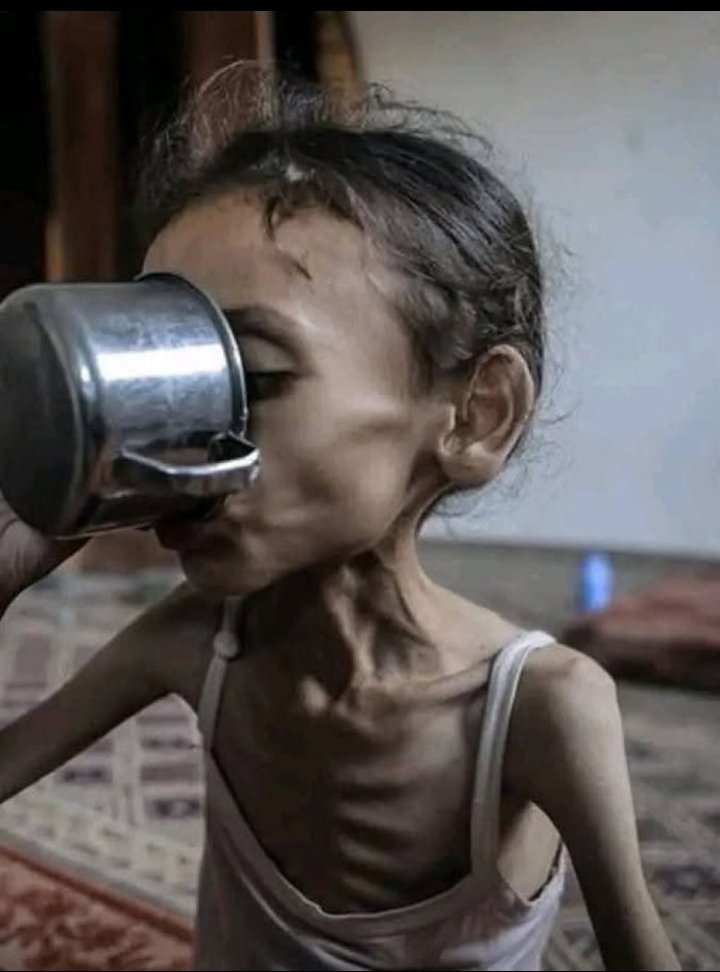 ALAMINH09762172's tweet photo. "The Gaza strip is facing a man made devastating famine." https://t.co/rVoGNNd4ST